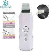 Ultrahangos bőrradír vibrációs arctisztító spatula mitesszer eltávolító lapát Ance Clean kavitációs peeling arc lifting