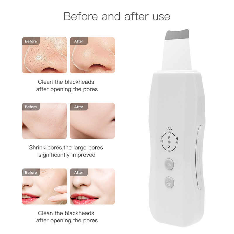 Ultrahangos bőrradír vibrációs arctisztító spatula mitesszer eltávolító lapát Ance Clean kavitációs peeling arc lifting