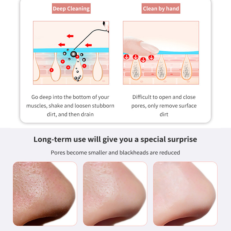 Ultrahangos arcbőrradír akne mitesszer eltávolító peeling lapát Pórustisztító masszírozó bőrápoló Ultrahangos tisztítás