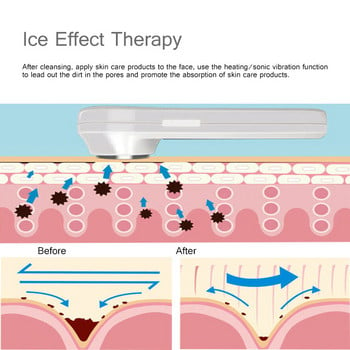 Електрически масажор за лице Горещ студен чук Ултразвукова криотерапия Вибрация на лицето Свиване на порите Спа Йон Инструмент за красота