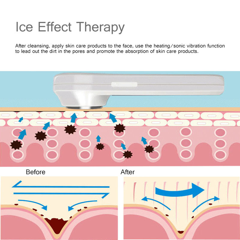 Masaj electric pentru frumusețea feței Ciocan rece fierbinte Crioterapie cu ultrasunete Vibrații faciale Micșorarea porilor Instrument de frumusețe cu ioni de spa