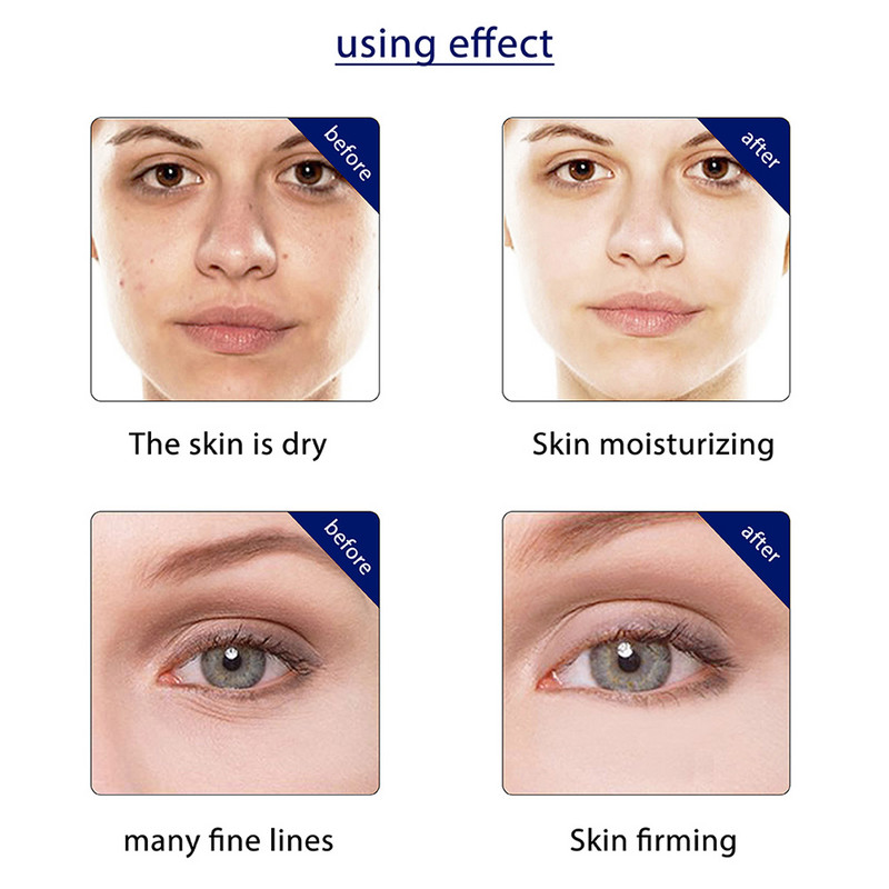 Ultrazvučni bipolarni RF radiofrekvencijski lifting masažer za njegu kože lica Mini Hifu Vibracijski uređaj za uljepšavanje protiv bora