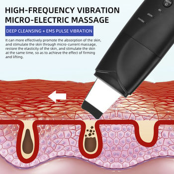 Ултразвуков скрубер за кожа Масажор за лице Премахване на черни точки Препарат за почистване на лице Препарат за почистване на пори Дълбока грижа за лицето Устройство за звуков пилинг