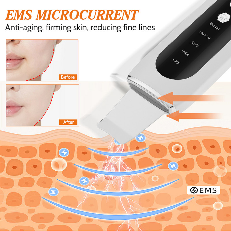 Ultrahangos bőrradír EMS mikroáram lapátoló gép mitesszer távolítsa el az arc mélytisztítását szépségápolási műszer Skin Lift