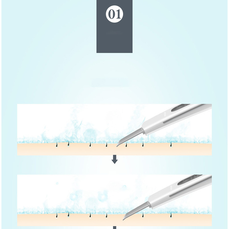SONOFLY ultrahangos bőrradír EMS pulzusos mélytisztító akne mitesszer eltávolító arc peeling lifting szépségápolási eszközök A4