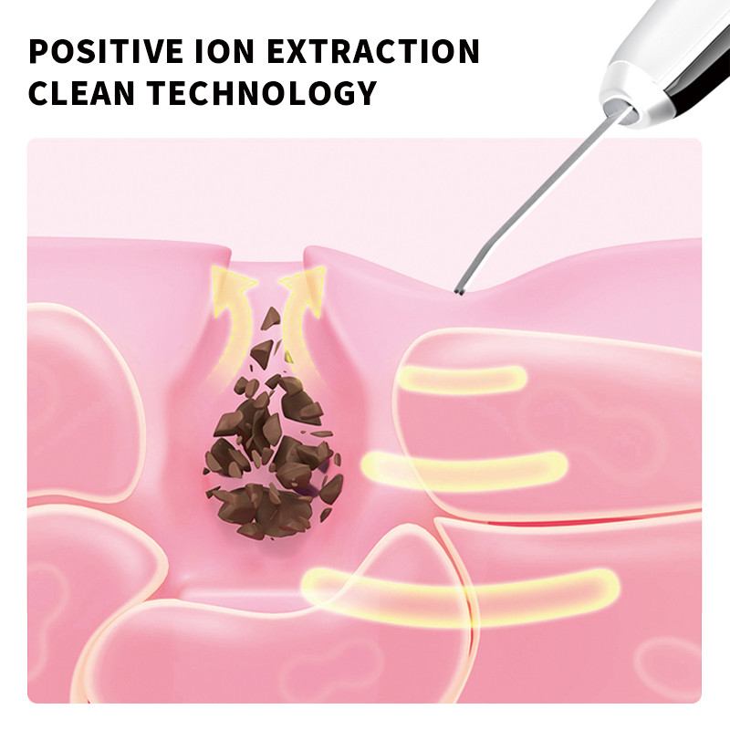 Bőrradír lehúzó arctisztító peeling gép mitesszer eltávolító pórustisztító ultrahangos szépségápolási eszköz