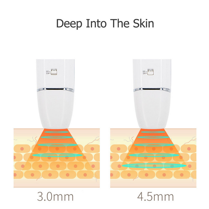 Mini Hifu Ultrasonic RF veido pakelianti raukšles šalinanti linija V formos odą stangrinanti akių priežiūra grožio priemonė, skirta namų SPA