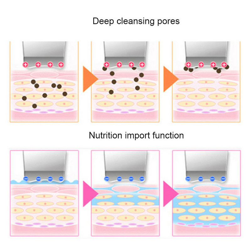 Ultrahangos bőrradír Arcpórusok Hámlasztás Tiszta mitesszer Ultrasonicspatula arcbőrápoló Beauty Scarping Spatula készülék