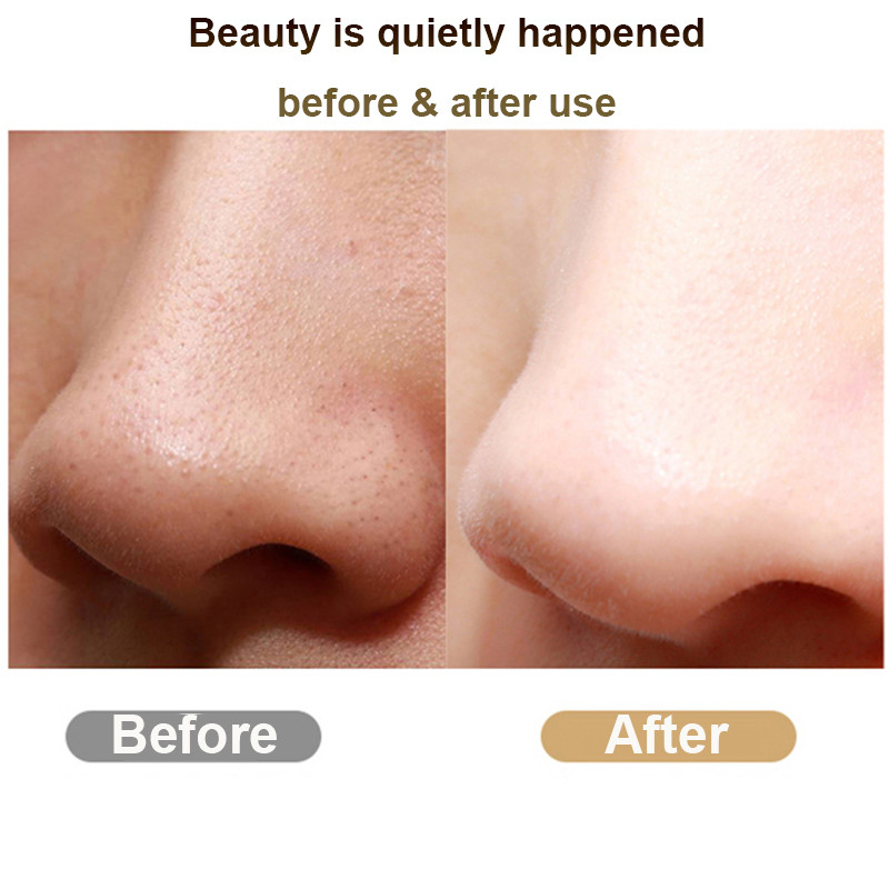 Novi ultrazvučni kožni nož Čistač kože Piling Sredstvo za uklanjanje mitesera Dubinsko čišćenje lica Ultrazvučni ionski čistač pora Čišćenje lica