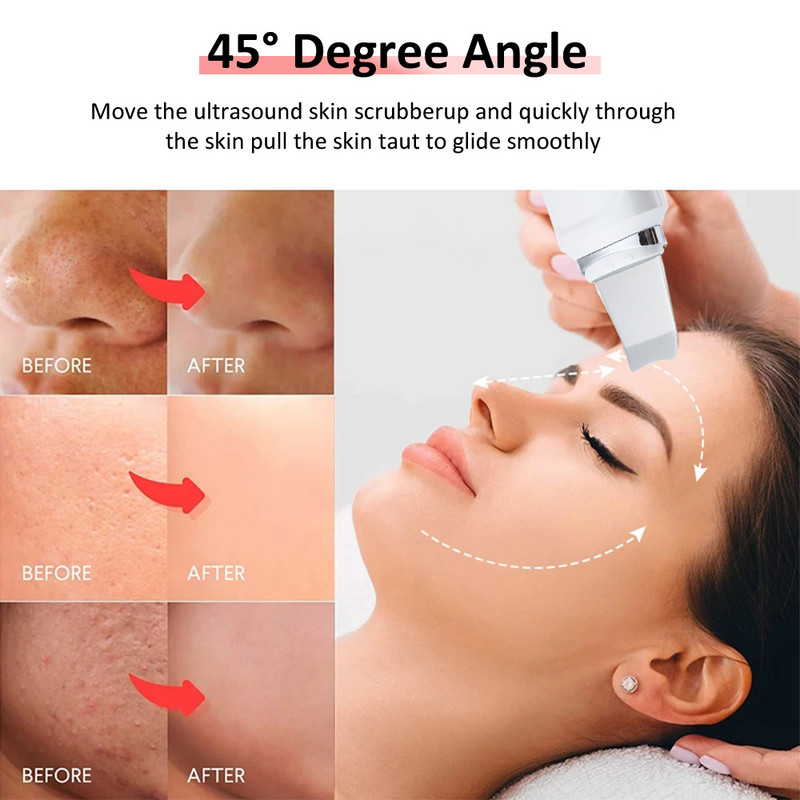Ultrazvučni piling kože Vibraciona masaža lica za uklanjanje mitesera Spatula za lice Lopata Čišćenje pora Piling Kavitacija