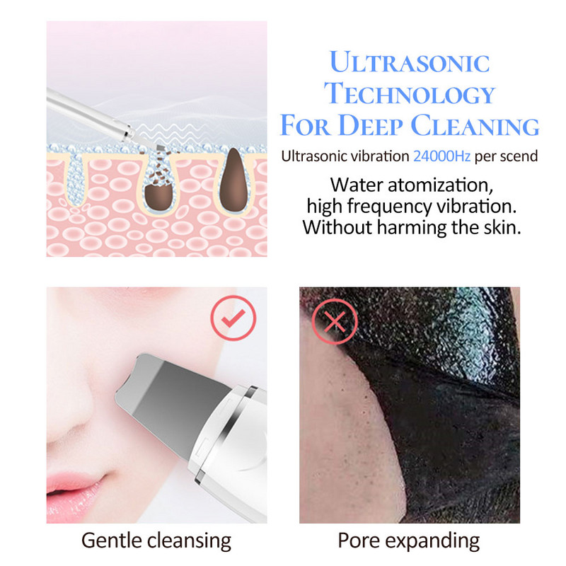 Ultrahangos bőrradír mély arctisztító gép peeling lapát arc pórustisztító arc lifting gép mitesszer eltávolító