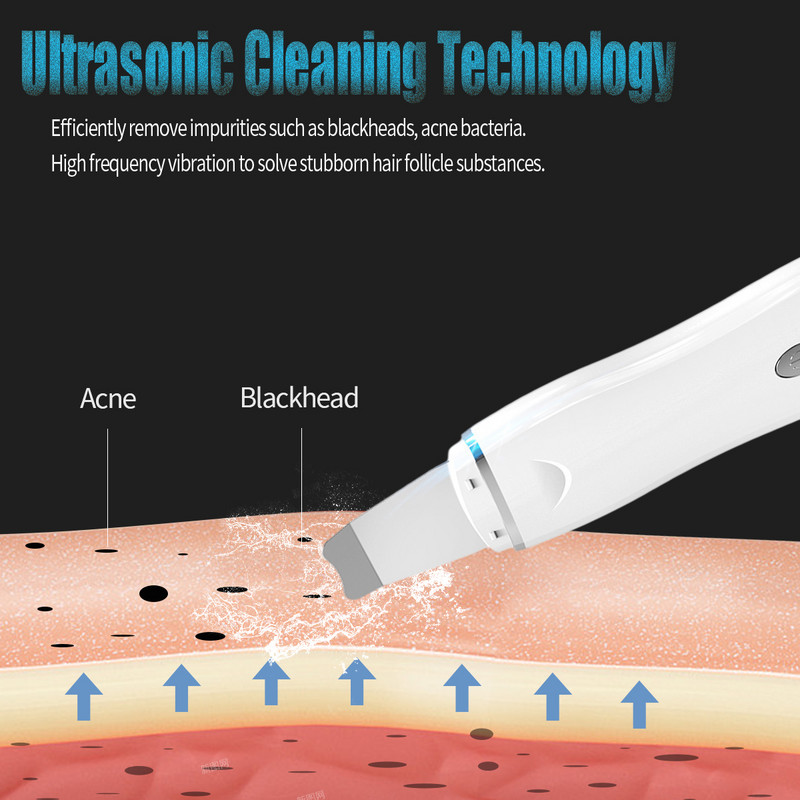 Bőrradír elektromos ultrahangos tisztító arcápoló lemosó mitesszer eltávolító peeling lapát Spatula masszírozó szépségápolási eszköz