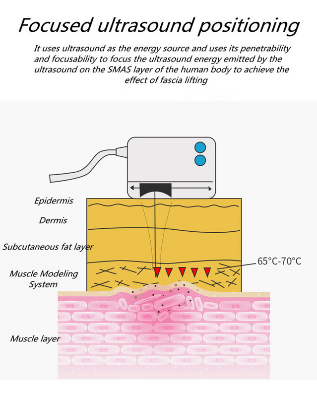 Naujas „MiNi HIFU“ didelio intensyvumo fokusuotas ultragarsinis veido pakėlimo aparatas RF veido pakėlimas nuo raukšlių ultragarso terapija 2021 m.