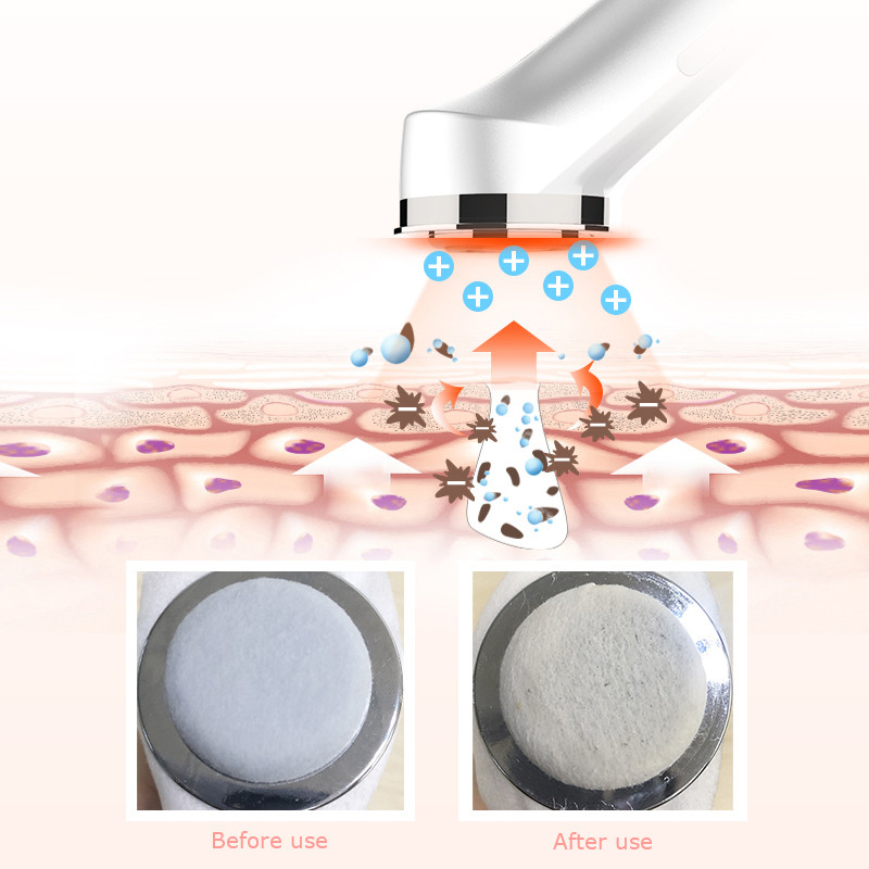 Prietaisai asmenims Veido masažo aparatas Ultragarsinis Veidas Lipo kavitacija Liftingas Lipolizė Radijo dažnio lieknėjimas Grožis