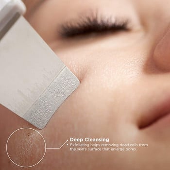 Fieezoe Beauty Face Cleaner Ultrasonic Skin Scrubber Plug USB Remover Blackhead Facial Massager Περιποίηση δέρματος ακμής Peeling Cavitation