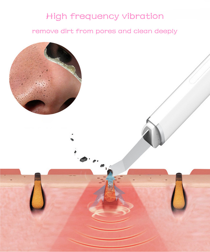 Fieezoe Beauty Face Cleaner Ultragarsinis odos šveitiklis USB kištukas inkštirų valiklis Veido masažuoklis Spuogų odos šveitimas Kavitacija