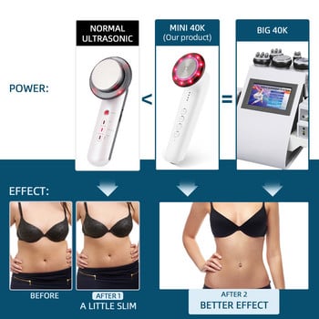 Φορητό φορητό μηχάνημα αδυνατίσματος σώματος Ultrasonic 40K Cavitation, αντι-λιπώδης καυστήρας κυτταρίτιδας Photon Skin Rejuvenation Device