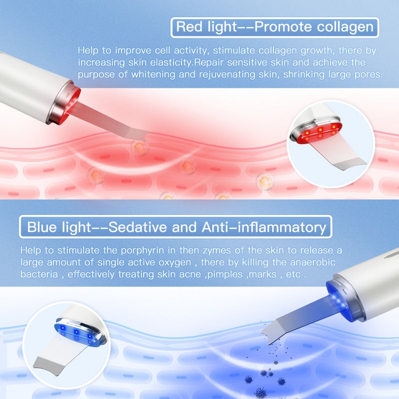 ANLAN Red Light bőrápoló ultrahangos bőrradír mély arctisztító peeling lapát arc pórustisztító arc lifting gép