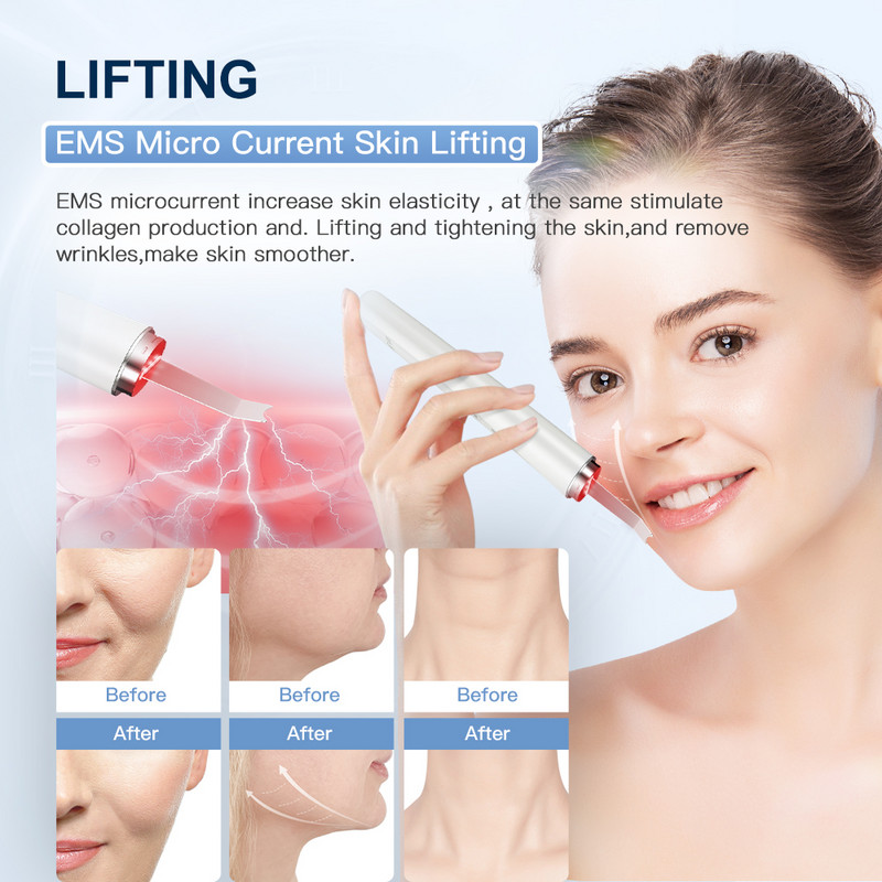 ANLAN Red Light bőrápoló ultrahangos bőrradír mély arctisztító peeling lapát arc pórustisztító arc lifting gép