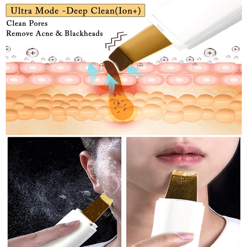 24 kHz-es ultrahangos bőrradír Nano Mist hidratáló pórustisztító készülékkel, arcradírozó hámlasztó gép