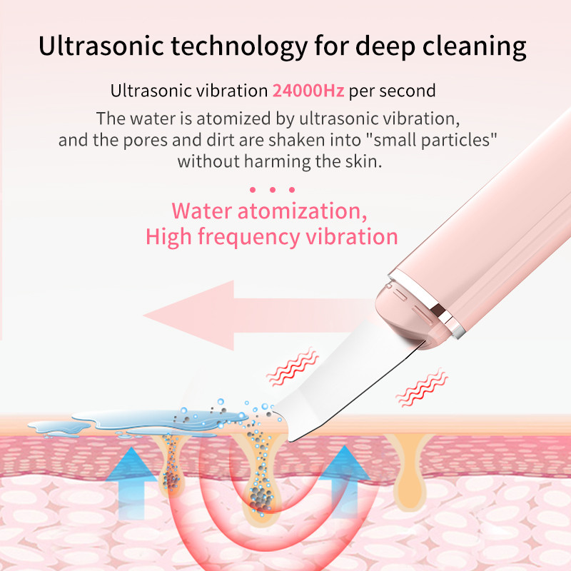Ultrahangos bőrradír Vibrációs mély arctisztító spatula mitesszer eltávolító lapát Kavitációs peeling arc lifting bőrápolás