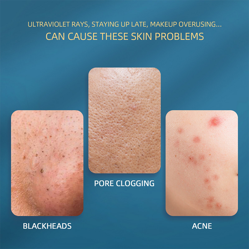 Bőrradír Ultrahangos Ion Arc Mélypórusos Peeling Tisztító Készülék Peeling Lapát Hámlasztó Mitesszer eltávolító Arc lifting
