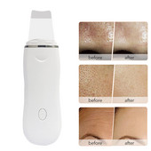 Красота Ултразвуков почистващ масажор за лице Нос Дълбоко почистване Премахване на черни точки Скрубер за кожа Ексфолиращ пилинг Грижа за лицето