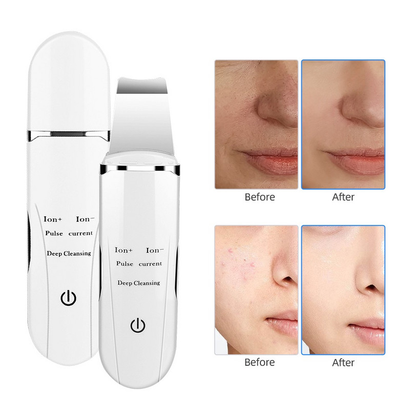 Ultrahangos bőrradír pórus mélytisztító elhalt bőr eltávolítása arc peeling mitesszer hámlasztás lapát lifting szépség készülék