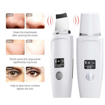 Ултразвуков почистващ препарат Face Scrubber Led Ems Ionic Massager For Face Peeling Lifting Microcurrents for face Грижа за кожата шпатула