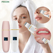 Ultrahangos bőrradír peeling lapát mitesszer akne eltávolító pórus spatula ultrahangos arctisztító arc lift Z9