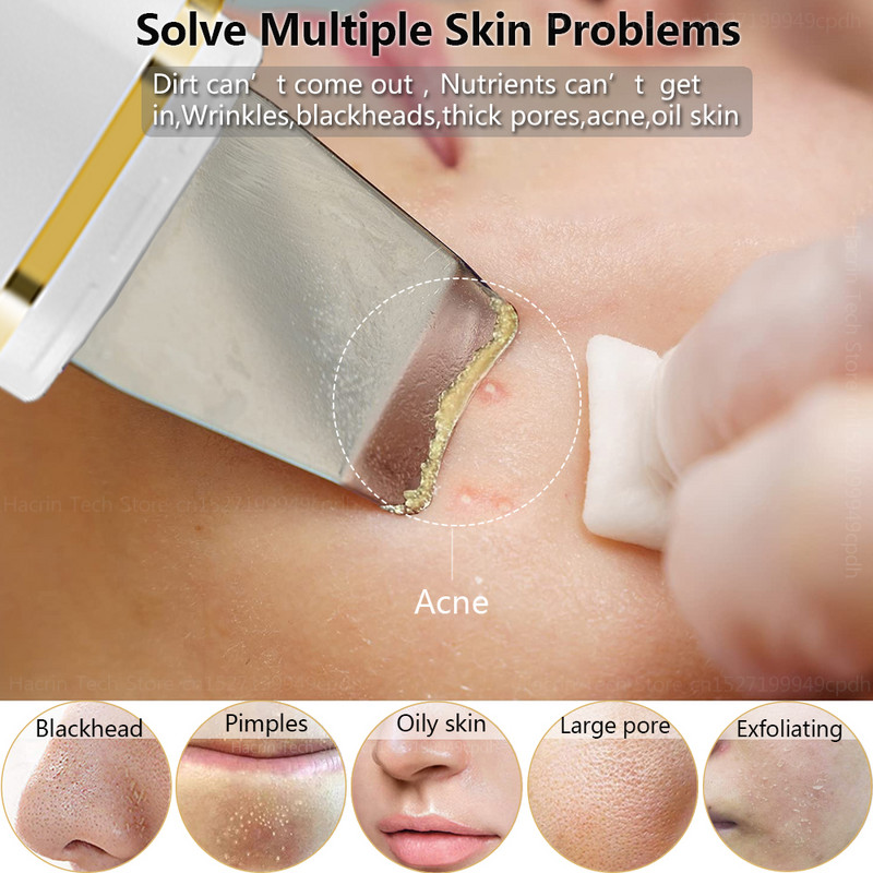 Ultrahangos bőrradír peeling lapát mitesszer akne eltávolító pórus spatula ultrahangos arctisztító arc lift Z9