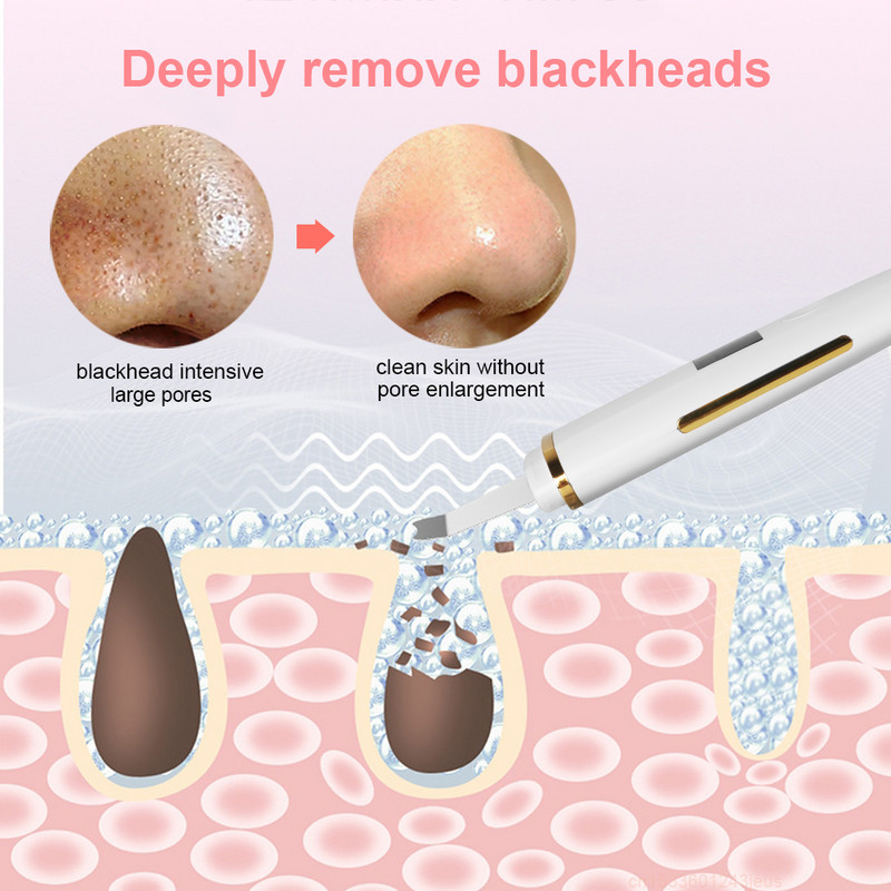 Ultrahangos bőrradír peeling lapát mitesszer akne eltávolító pórus spatula ultrahangos arctisztító arc lift Z9