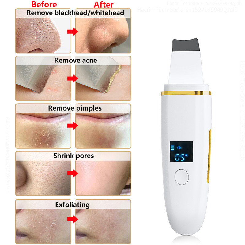 Ultrahangos bőrradír peeling lapát mitesszer akne eltávolító pórus spatula ultrahangos arctisztító arc lift Z9