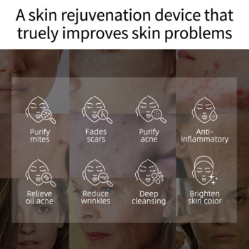 Blue Light Laser Face Massager Συσκευή θεραπείας με όζον Μηχάνημα αφαίρεσης ουλών ακμής πλάσματος κατά των ρυτίδων Skin Care Beauty Device