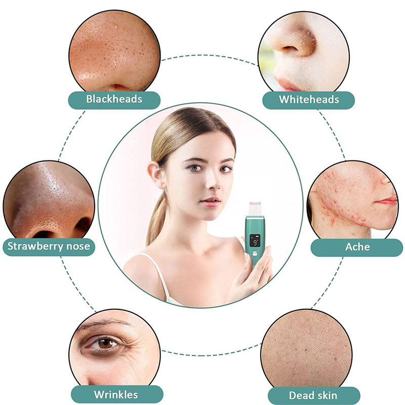 Arcbőrradír mitesszer eltávolító pórustisztító arcradír spatula mélytisztításhoz EMS Skin Lifting Beauty Device