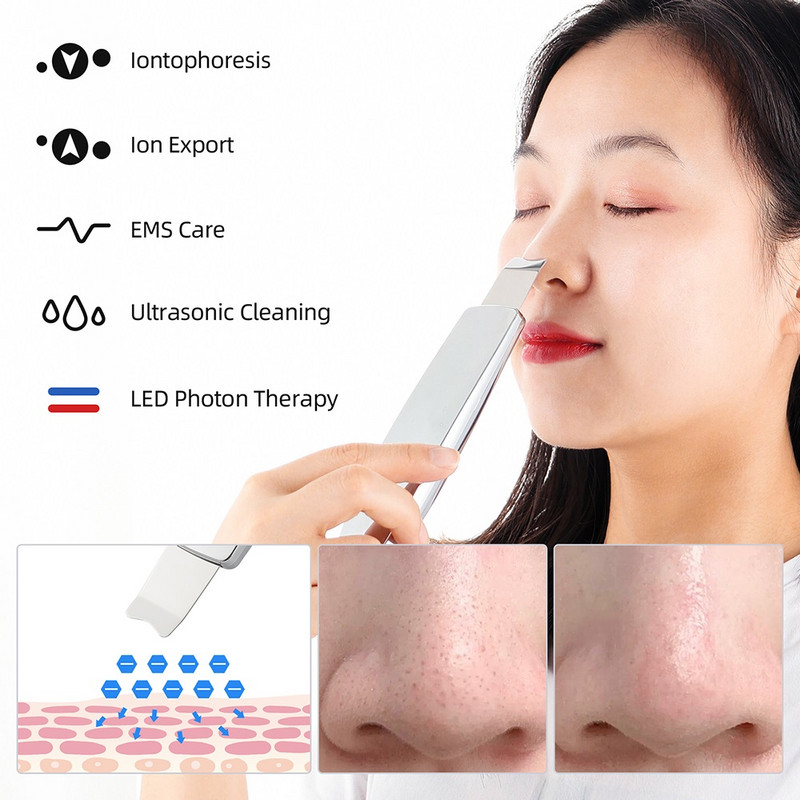 6 az 1-ben ultrahangos bőrradír arctisztító piros kék fény foton ion akne mitesszer eltávolító peeling lapát tisztító arc lifting