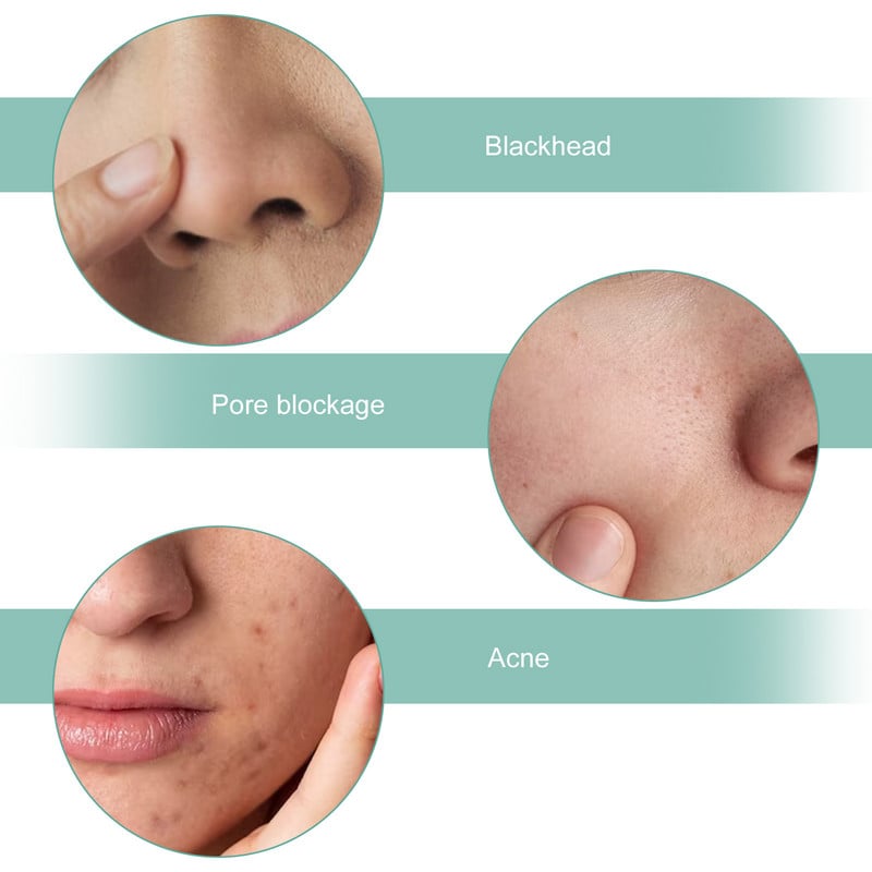 Beauty Ultrahangos bőrradír arctisztító mitesszer eltávolító arctisztító gépi bőrápoló akne masszírozó arc lifting
