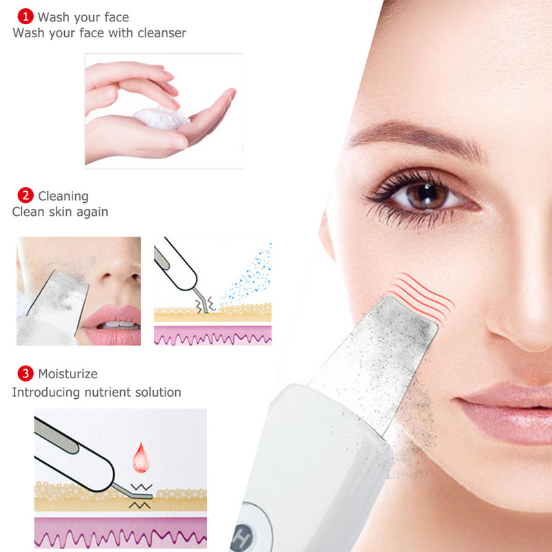 OLOEY Ultrazvučni piling kože Masažer Stroj za čišćenje kože lica Anjon za uklanjanje mitesera Čistač pora Piling kože