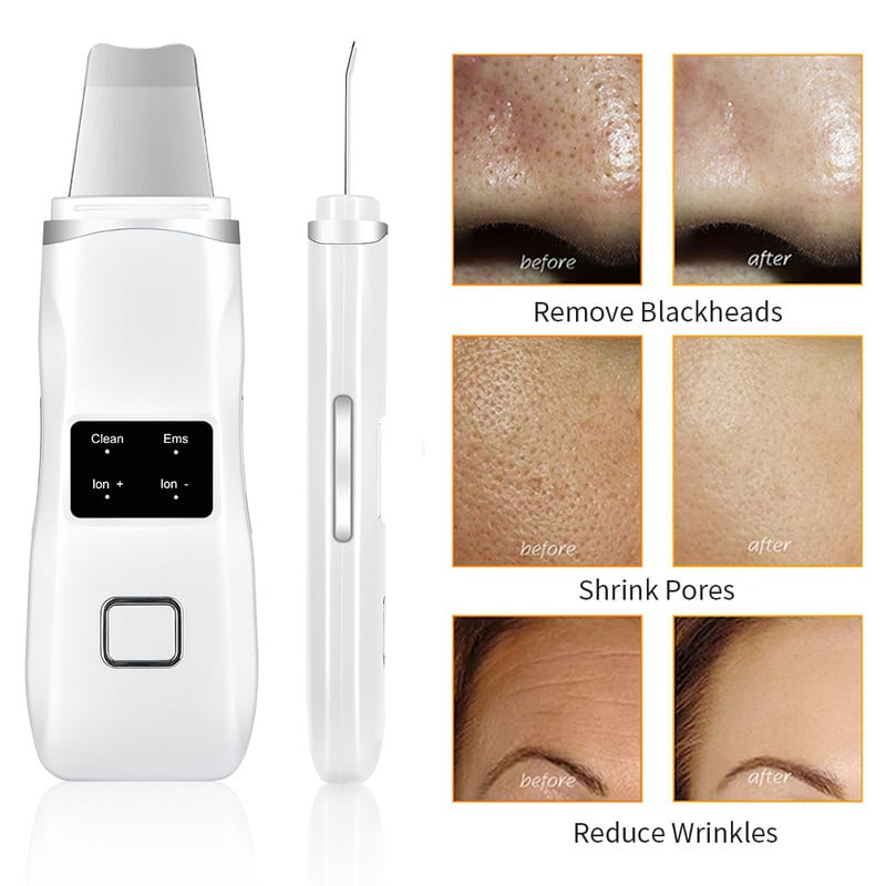 Ultrahangos bőrápoló súroló spatula arcmasszírozó holt bőr mitesszer eltávolítása ultrahangos arc peeling lifting eszközök