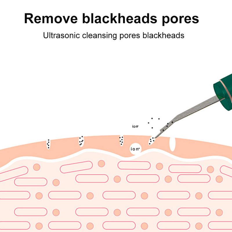 Professzionális ultrahangos arcbőrradír tisztító mitesszer peeling lapátos tisztító ion akne bőrápoló eszközök