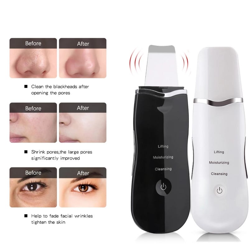 Ultrahangos bőrradír vibrációs arc spatula mitesszer eltávolító arcradír lapát Tiszta kavitációs peeling arc lifting