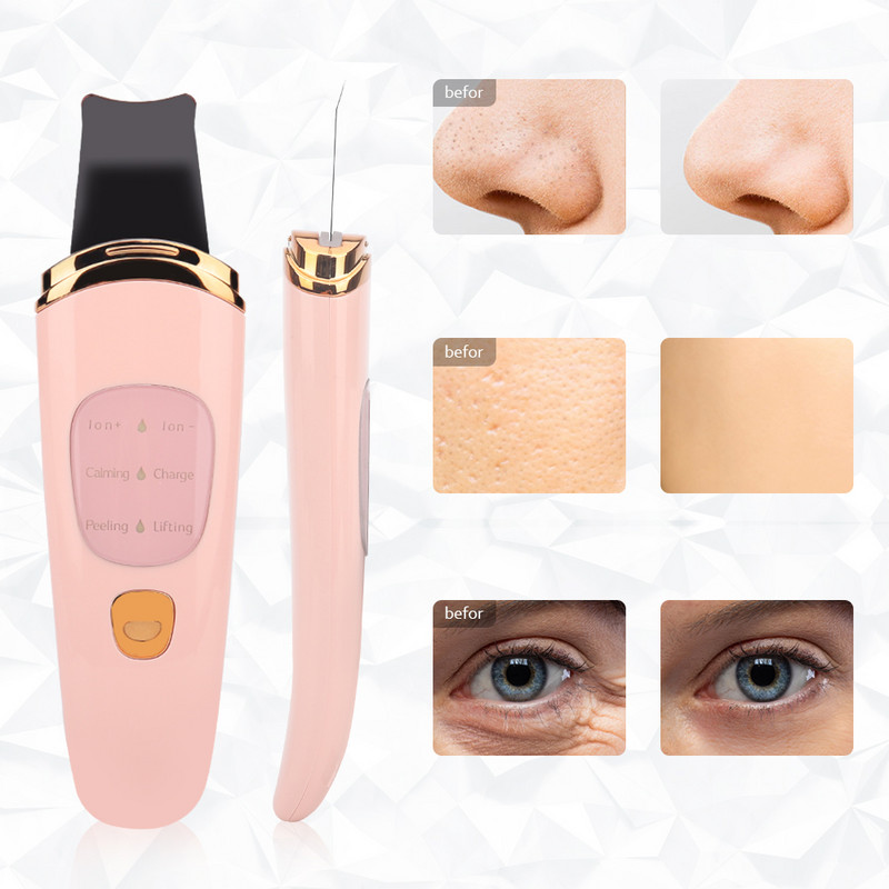 Ultrahangos Scrubber Skin Vibration Cleaner Spatula Mitesszer eltávolító Arcradír Lapát Kavitációs Peeling Arc lifting