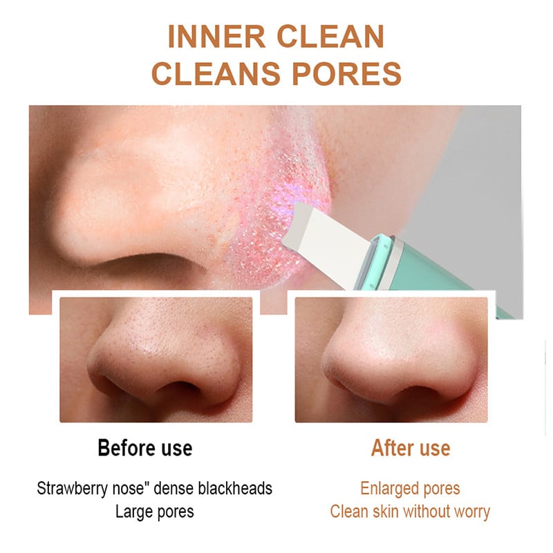 Ultrahangos bőrradír mélytisztító vibrációs arc spatula mitesszer eltávolító arcradír lapát tiszta kavitációs peeling