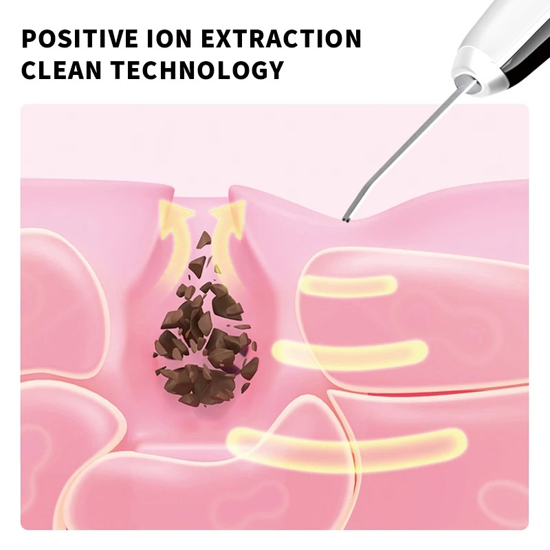 EMS Skin Scrubber arctisztító készülék peeling gép mitesszer eltávolító pórustisztító ultrahangos szépségápolási műszer