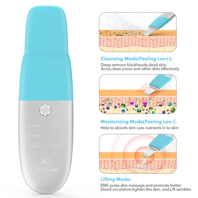 Youmay Skin Scrubber Vibrációs Arc Spatula Mitesszer eltávolító Arcradír Lapát Clean Kavitációs Peeling Arc lifting