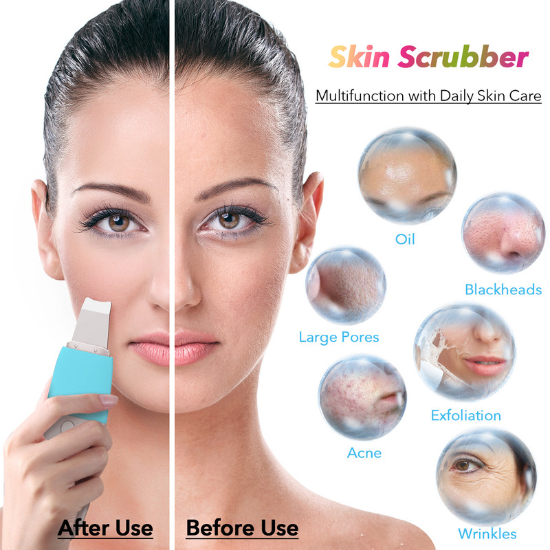 Youmay Skin Scrubber Vibrációs Arc Spatula Mitesszer eltávolító Arcradír Lapát Clean Kavitációs Peeling Arc lifting