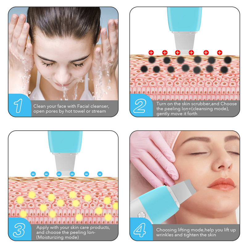 Youmay Skin Scrubber Vibrációs Arc Spatula Mitesszer eltávolító Arcradír Lapát Clean Kavitációs Peeling Arc lifting
