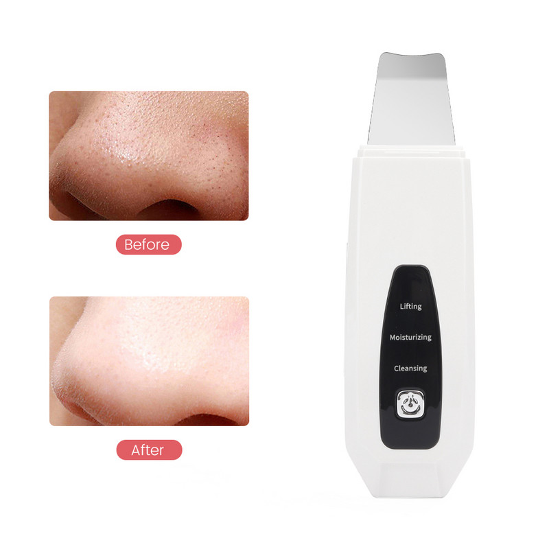 EMS ultrahangos bőrradír Bőrlapátoló gép mitesszer eltávolító akne pórus peeling Face Lift hámlasztó arctisztítás