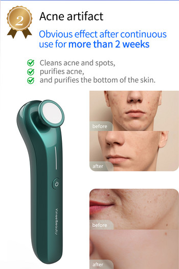 NO BOX Plasma Face Massager Scar Acne Removal Microcurrent massager Beauty Treatment Acne Remove Therapy Περιποίηση του δέρματος του προσώπου