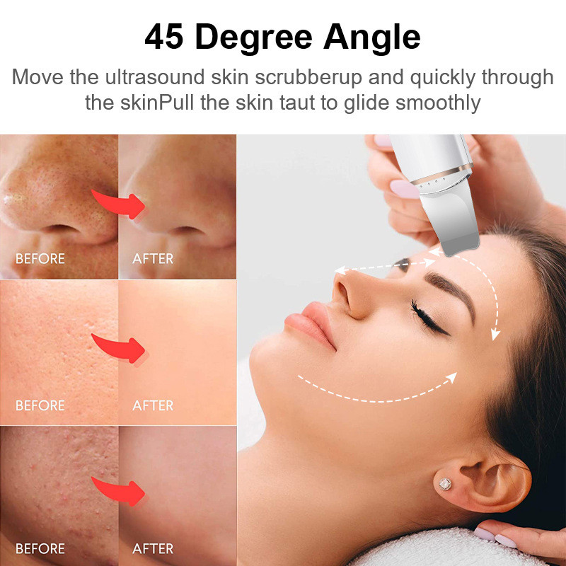 Υψηλής συχνότητας Ultrasonic Skin Scrubber Deep Cleansing Beauty Devices Εργαλείο αφαίρεσης μαύρων στιγμάτων προσώπου Φτυάρι καθαρισμού προσώπου